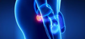 Sex after Prostate Surgery